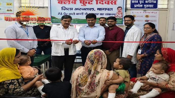 जिला अस्पताल में आयोजित हुआ क्लब फुट दिवस , टेढे पैर वाले बच्चों के उपचार का लिया गया संकल्प